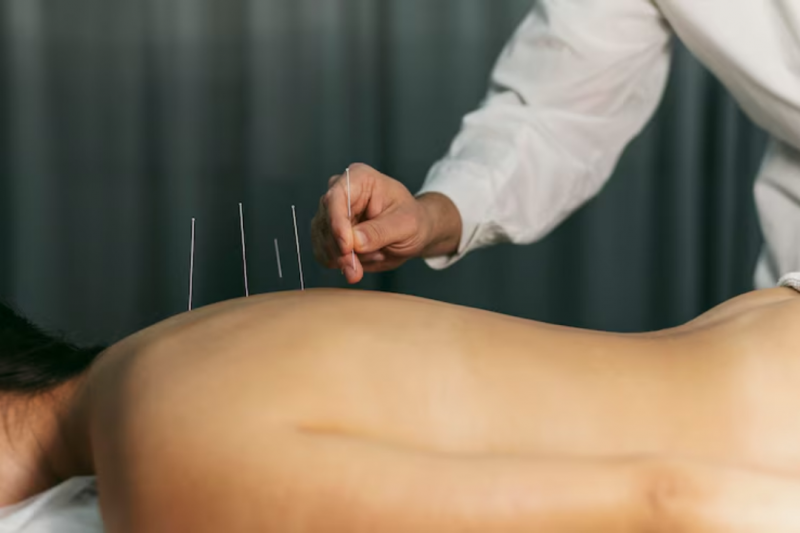 Acupuntura Cervical para Alívio da Dor e Bem-Estar Acupuntura Cervical para Alívio da Dor e Bem-Estar