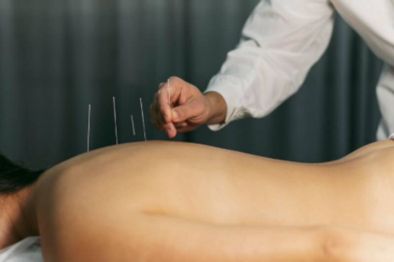 Acupuntura Coluna Alívio e Saúde para suas Costas Acupuntura Coluna Alívio e Saúde para suas Costas