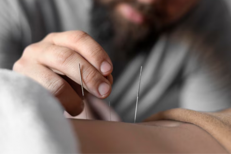 Como funciona a consulta com um acupunturista e o que esperar