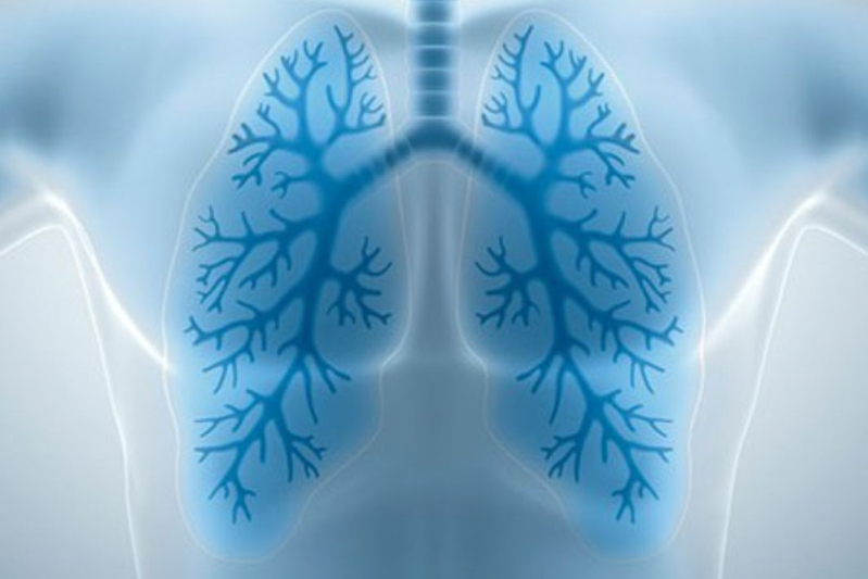 Clinica Que Faz Fisioterapia Pulmonar Joá - Fisioterapia para Os Pulmões Icaraí