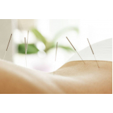 acupuntura coluna clínica Leme
