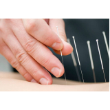 acupuntura dor consulta Recreio dos Bandeirantes