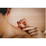 acupuntura cervical clínica Fonseca