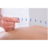 clínica especialista em acupuntura nervo ciático Botafogo